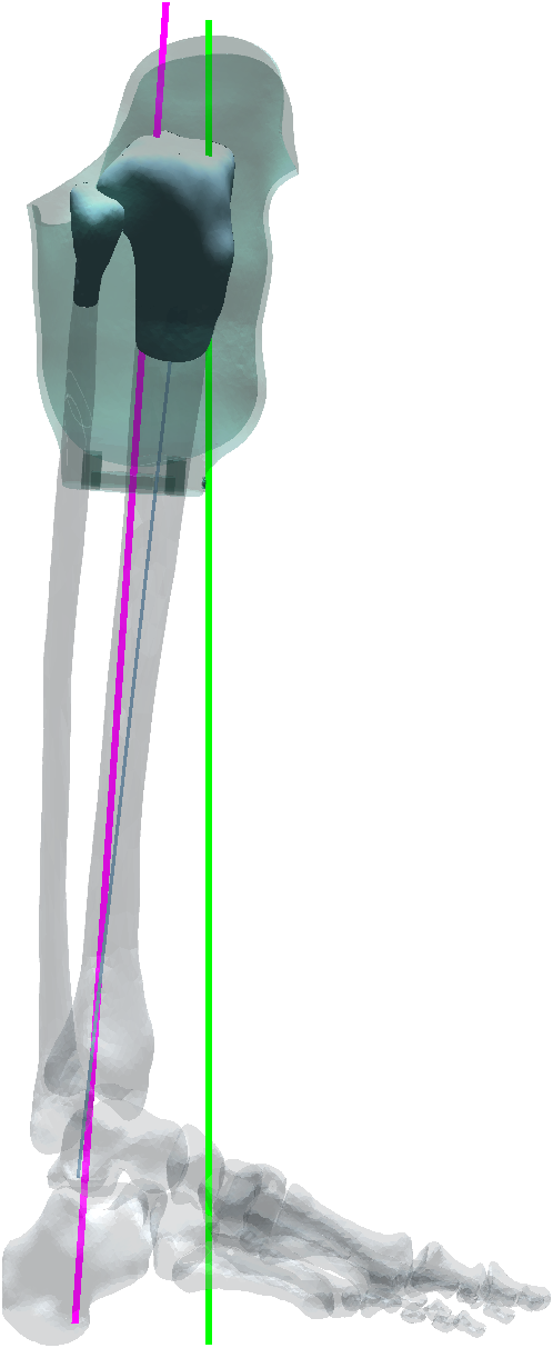 Sagittal view