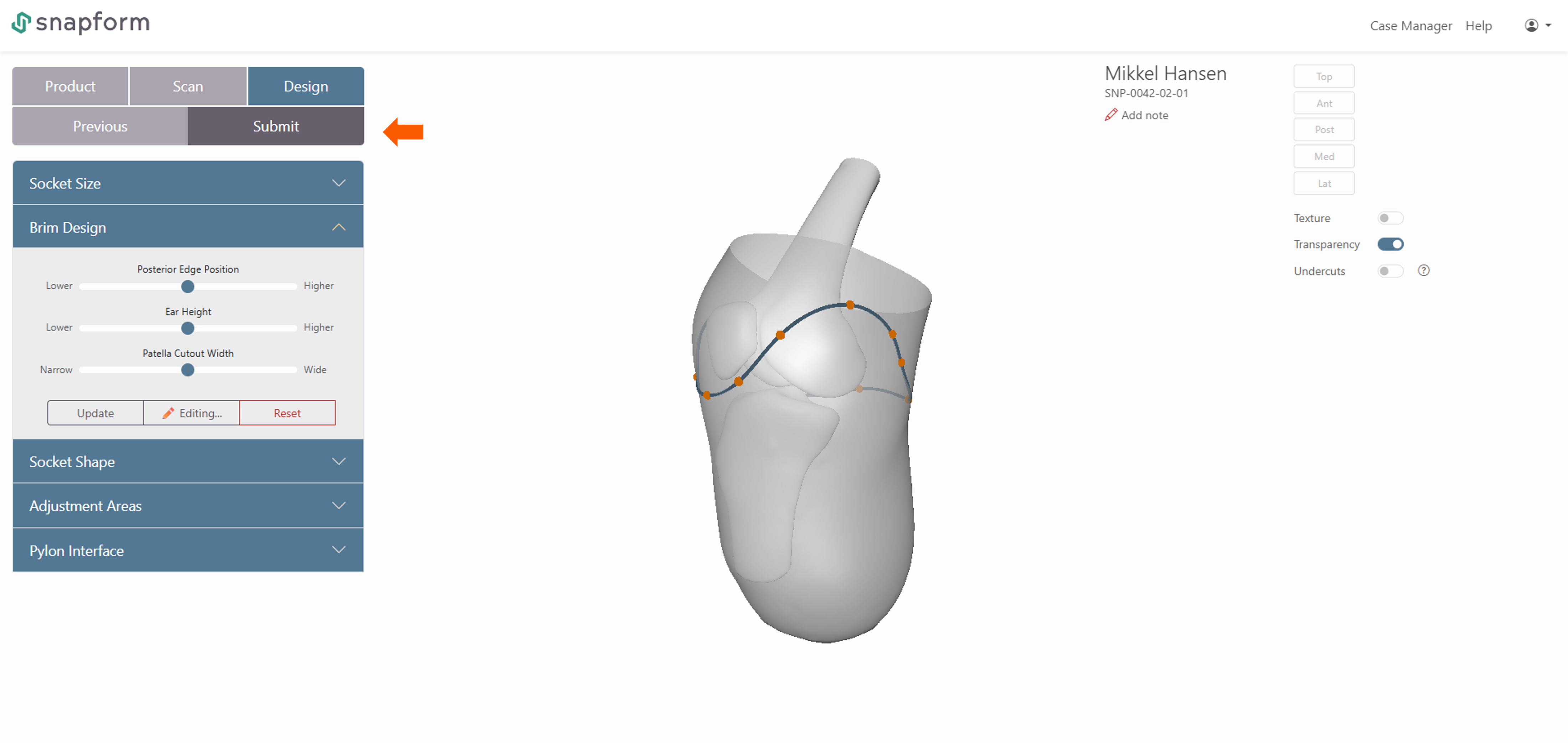 Workflow step 5