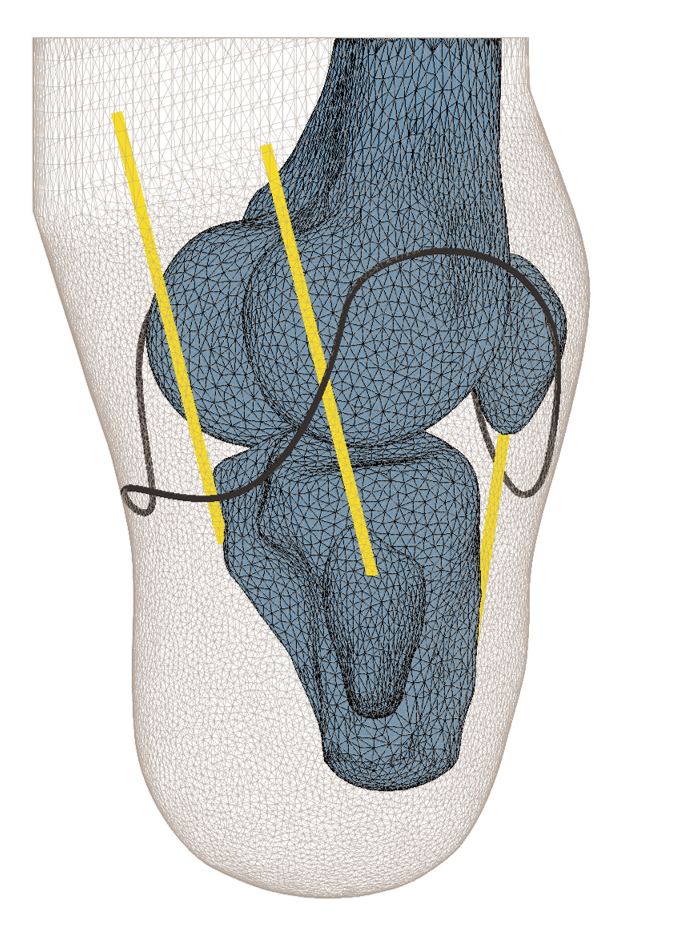 Patient-specific anatomy model